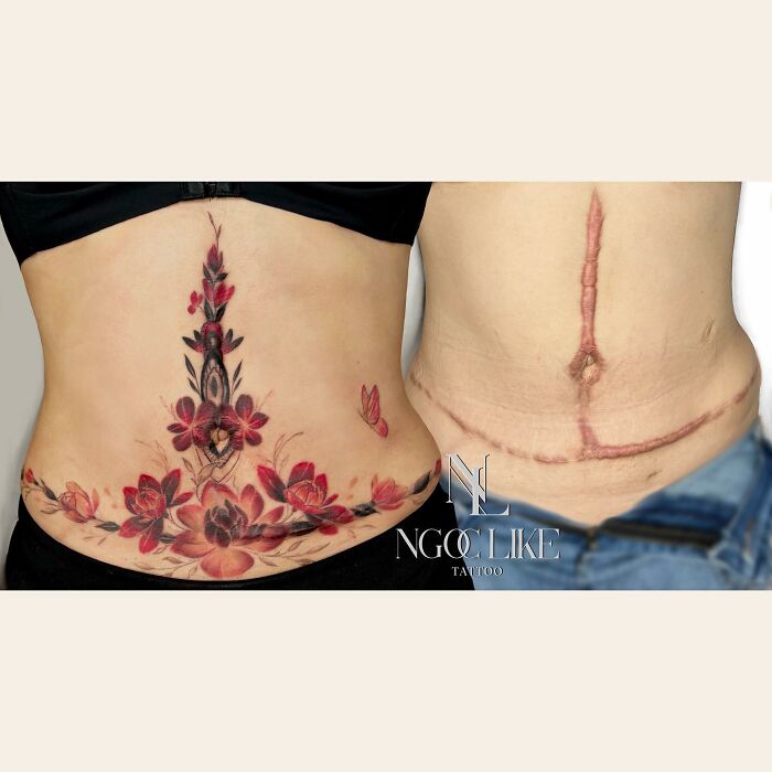 tummy tuck tattoos to cover up vertical scars